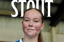 اسکای استوت 