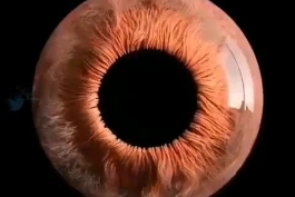 👀🔥 چشم انسان زیر میکروسکوپ/ویدئو