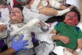  ببینید بمب فسفر با کودکان غزه چه کار می‌کند