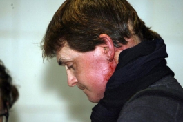 زمانی که حال تیتو خوب نبود!