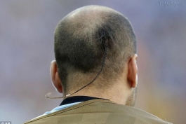 بدترین مدل موی جام جهانی
