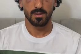 پیام عیسی مرادی پس از عمل جراحی در ناحیه صورت