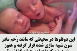 این دوقلوها هنوز نمیدونن به دنیا اومدن