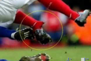 3عکس از شکستن پا و دست بازیکن به صورت یهویی:(