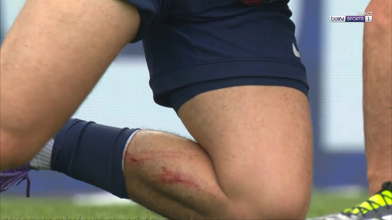 مصدومیت خویچا کواراتسخلیا - پاری سن ژرمن